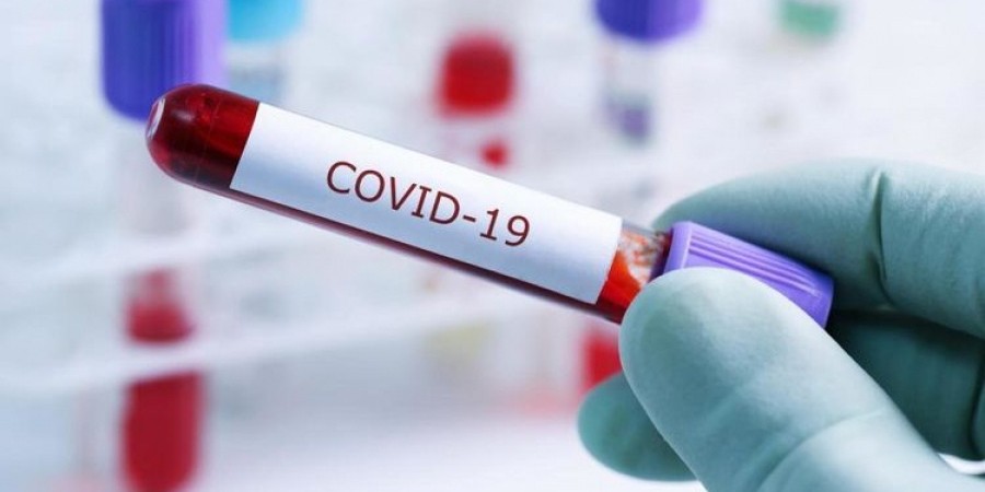 Какова ситуация с COVID-19 и статистика по заболевшим в странах Центральной Азии и СНГ